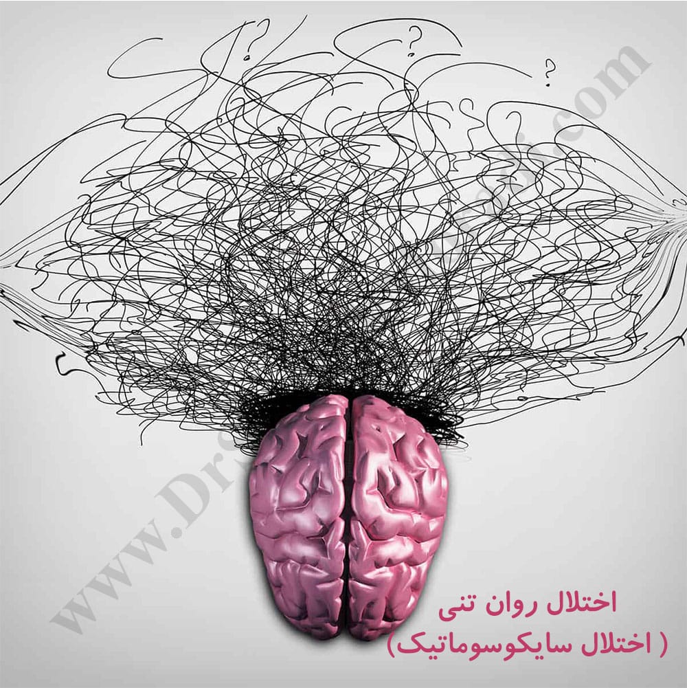 -روان-تنی.jpg