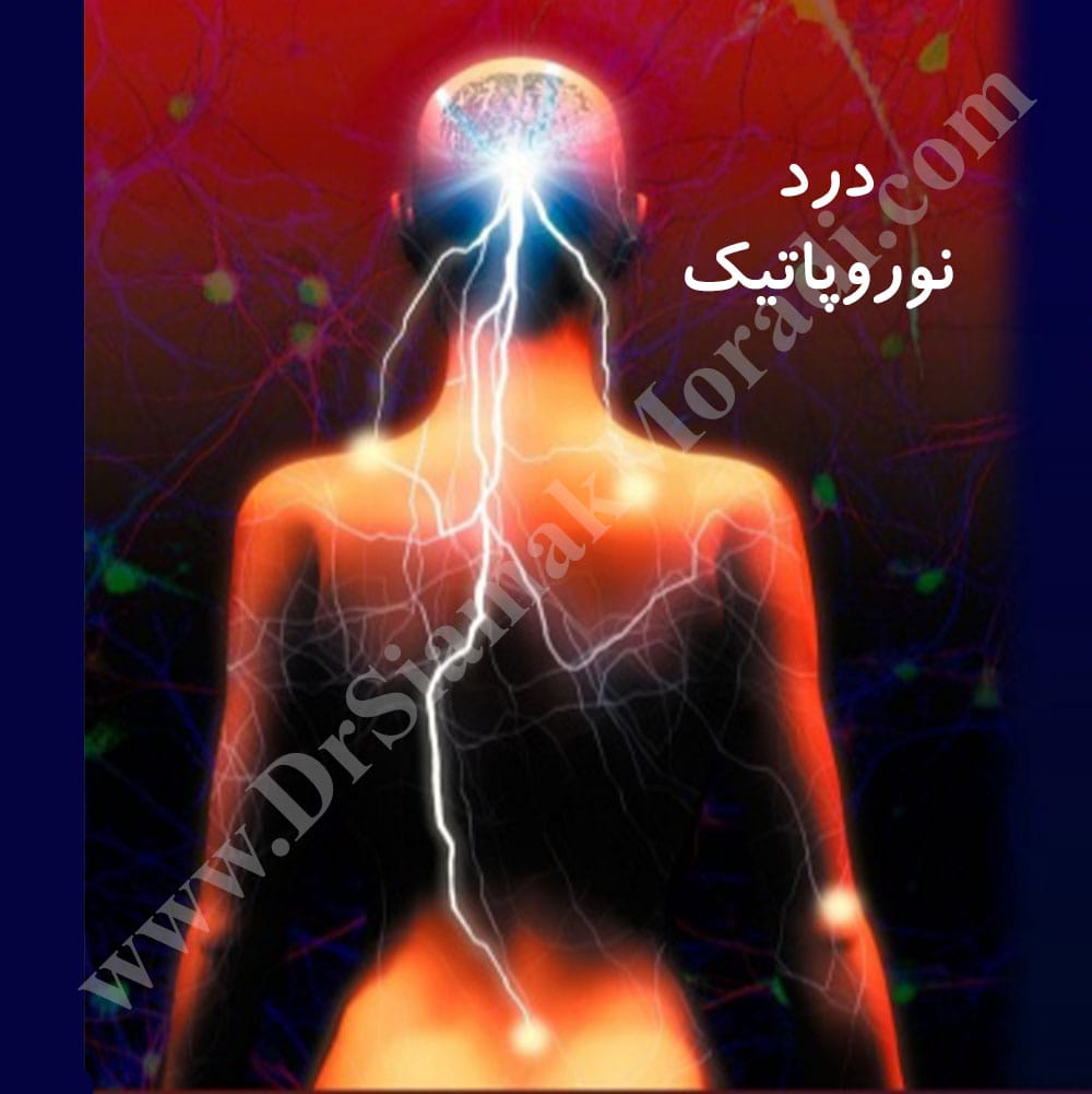 -نوروپاتیک.jpg1_.jpg
