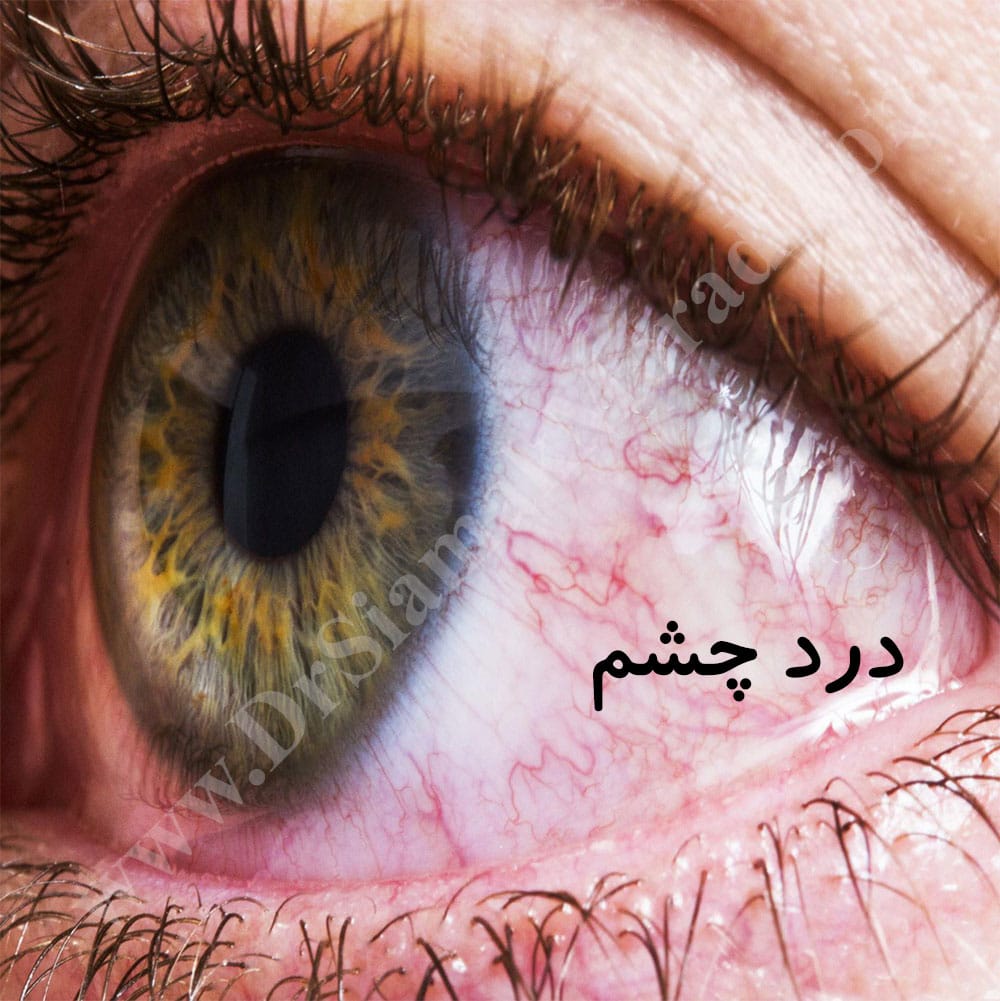 -درد-0.jpg