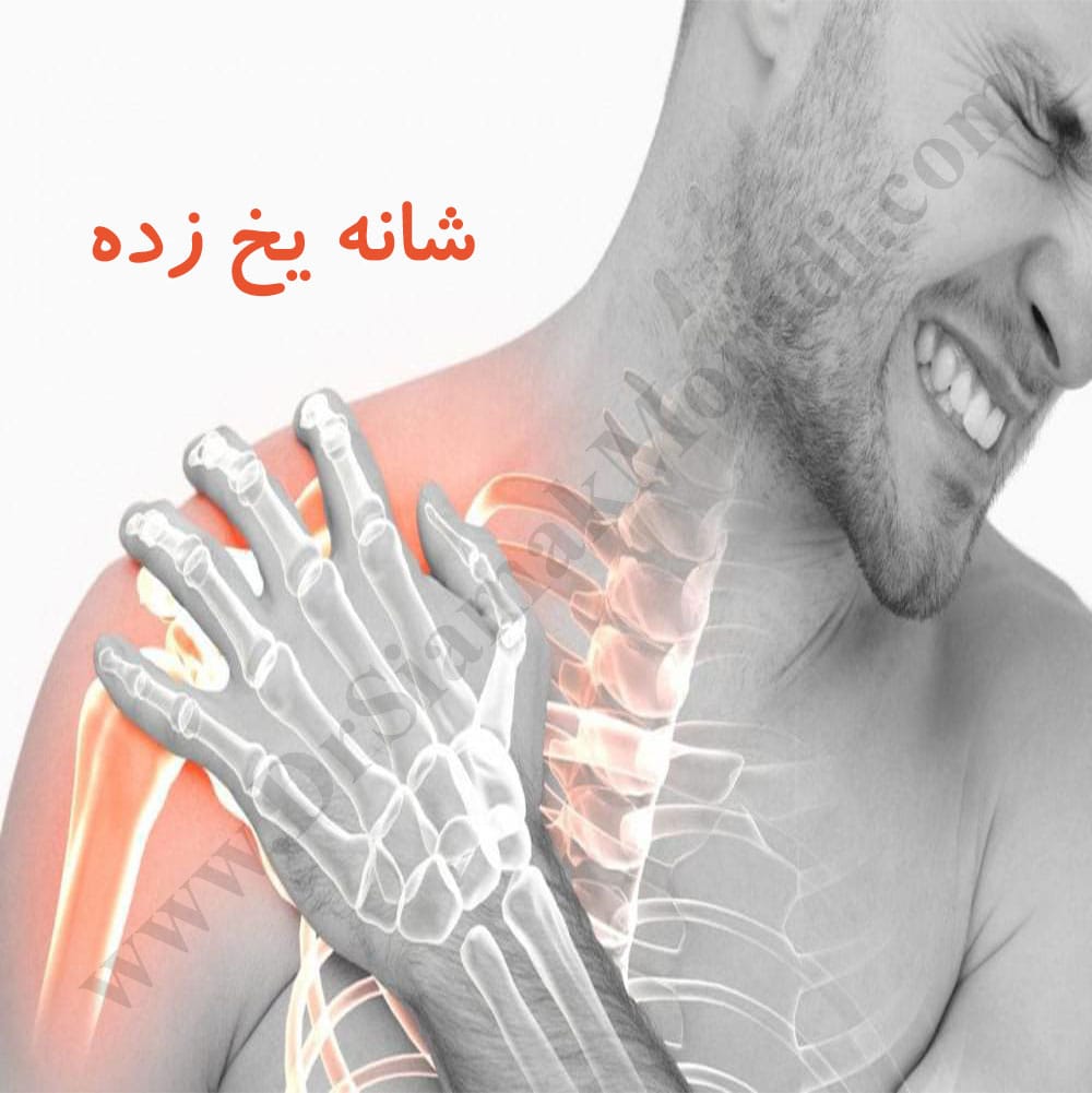 -یخ-زده.jpg