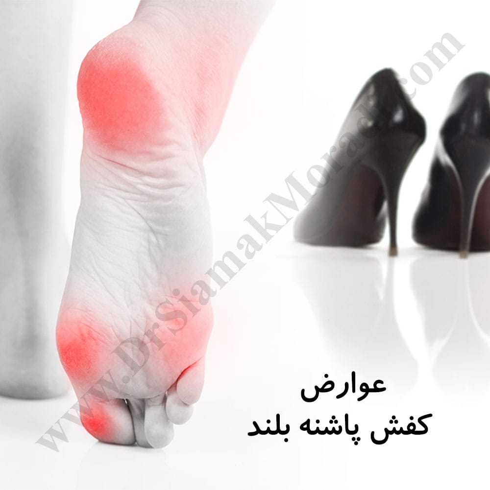 -پاشنه-بلند1.jpg