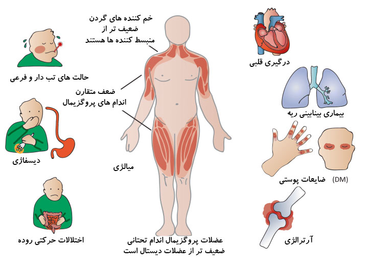 درمان میوپاتی توسط دکتر سیامک مرادی فوق تخصص درد در کلینیک درد تهران