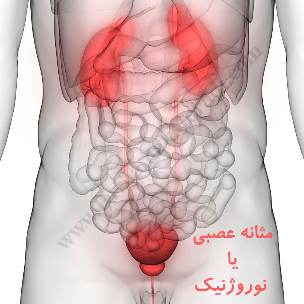 -عصبی-1.jpg
