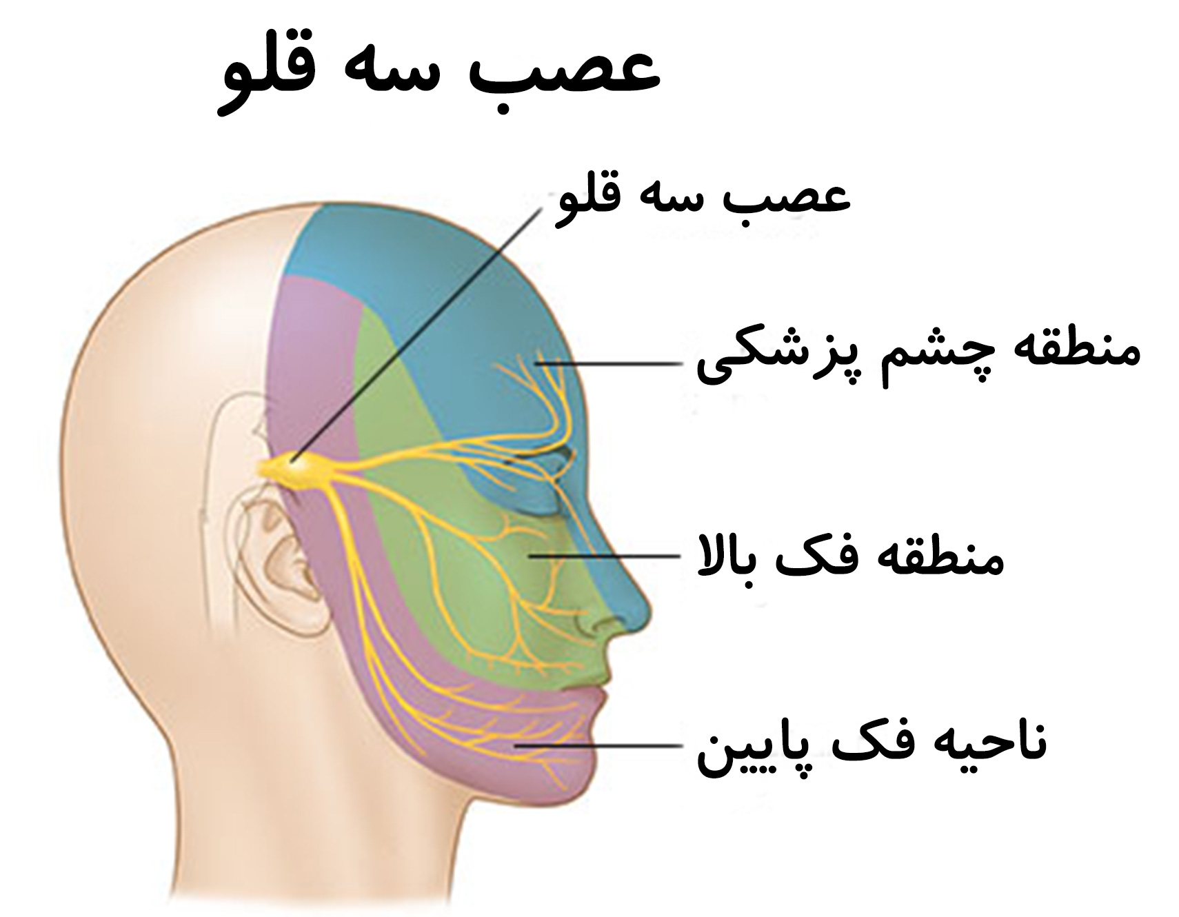 نورالژی عصب سه قلو توسط دکتر سیامک مرادی فوق تخصص درد در تهران در کلینیک درد راد