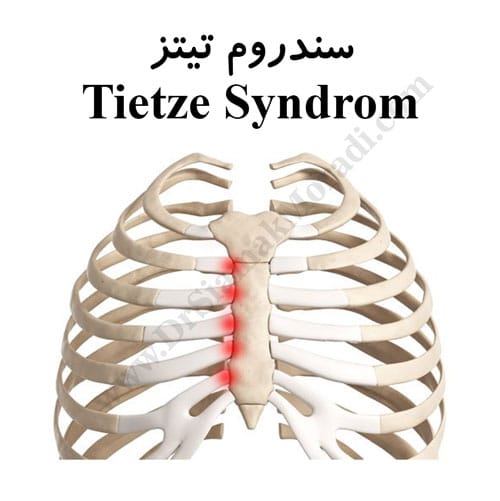 -تیتز-1.jpg