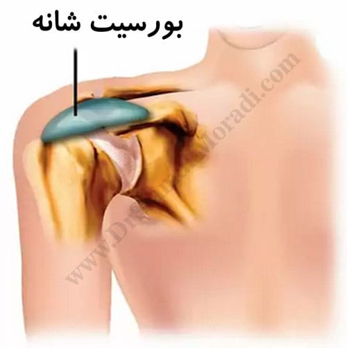 -شانه-1.jpg