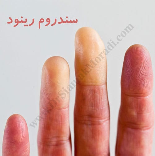 -رینود-8.jpg