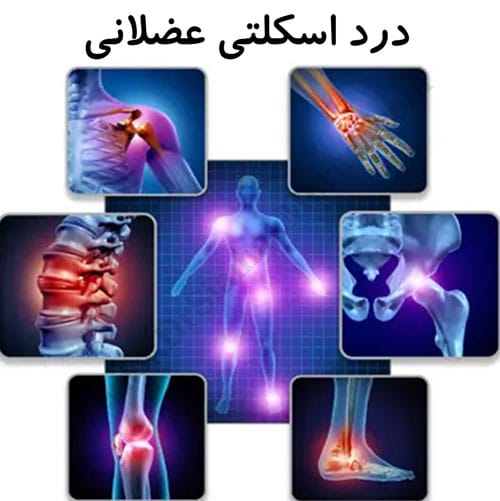 -اسکلتی-عضلانی-2.jpg