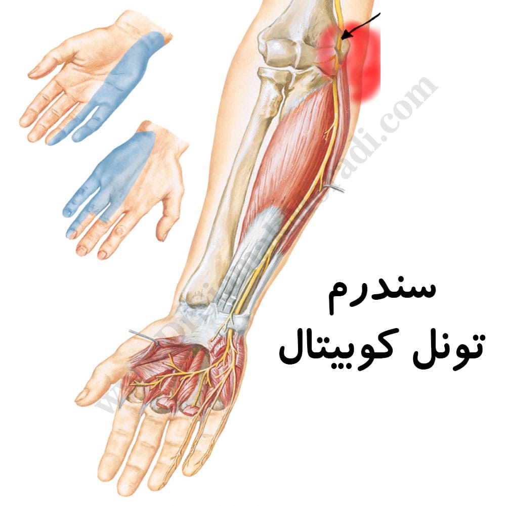 -تونل-کابیتال.jpg