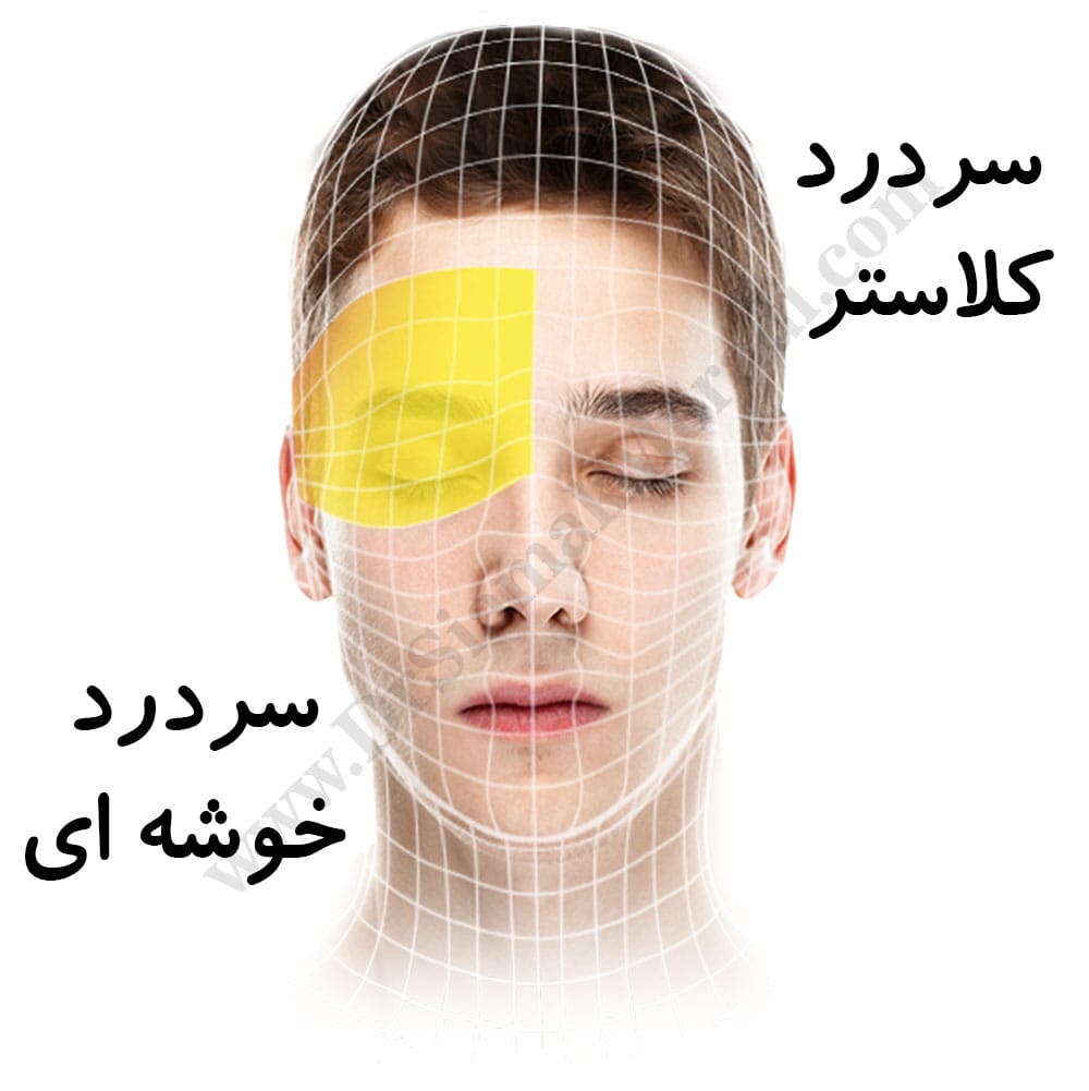 -خوشه-ای.jpg