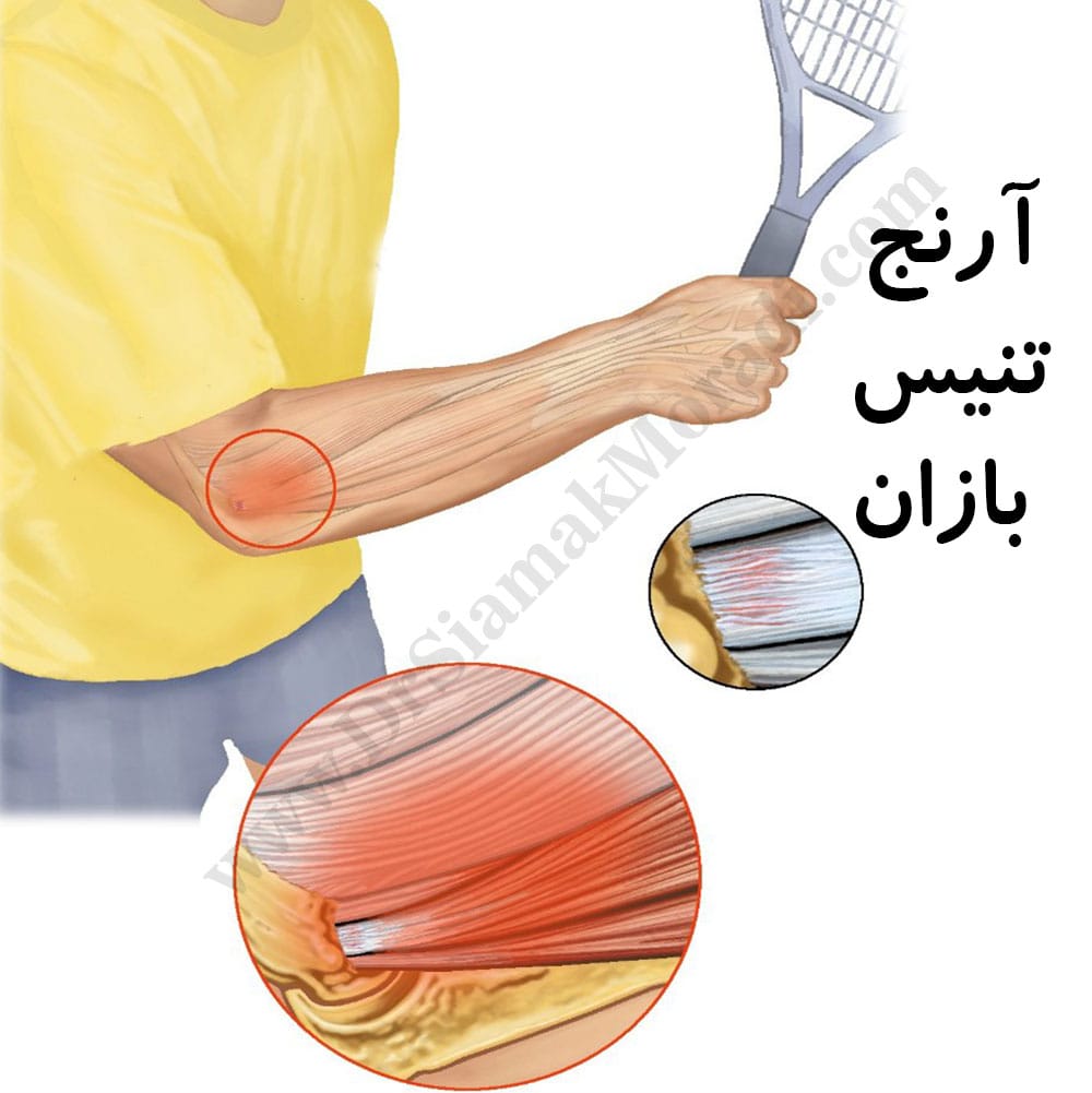 -تنیس-بازان-3.jpg