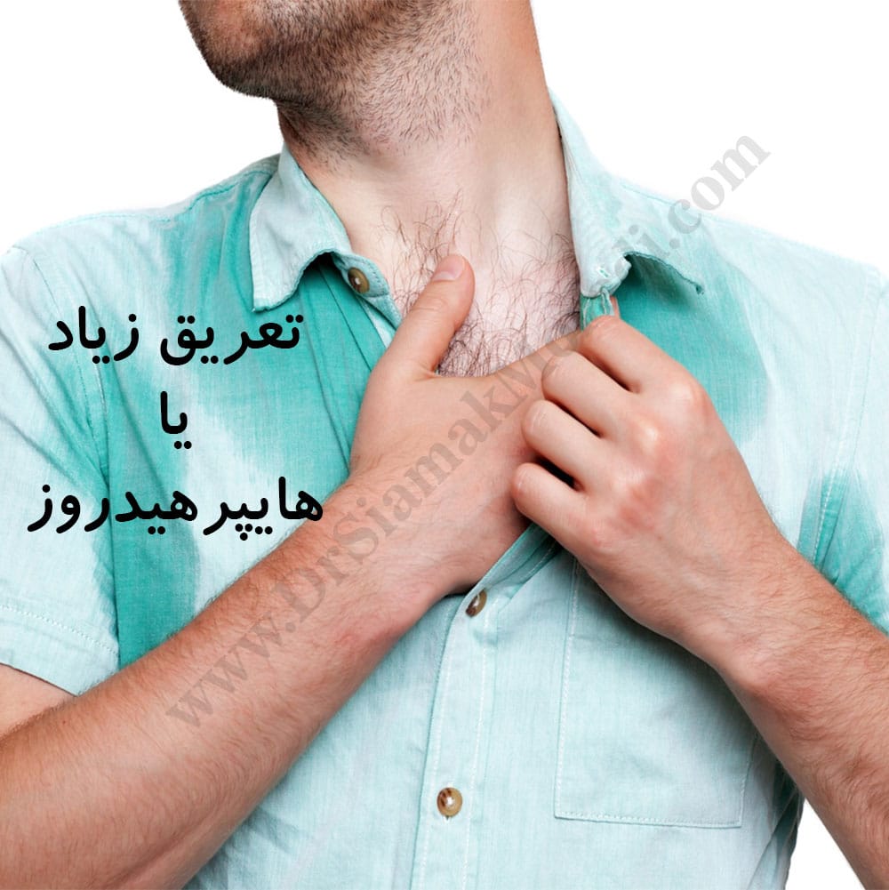 -زیاد-2.jpg