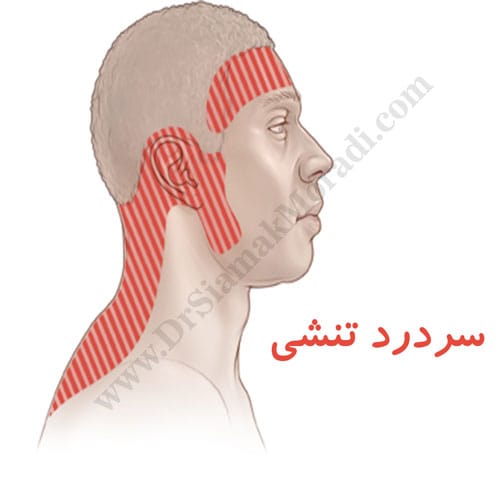 -تنشی-6.jpg