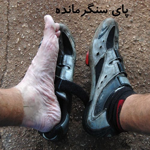 -سنگر-مانده-2..jpg